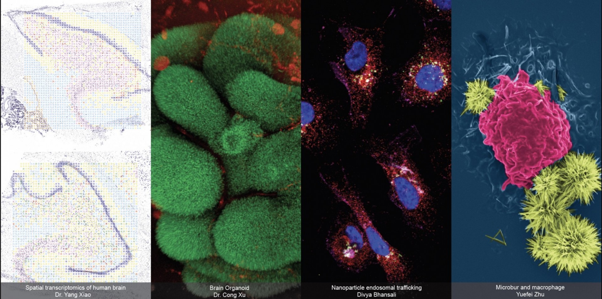 Left to right: spatial transcriptomics of human brain; brain organoid; nanoparticle endosomal trafficking; Microbur and macrophage